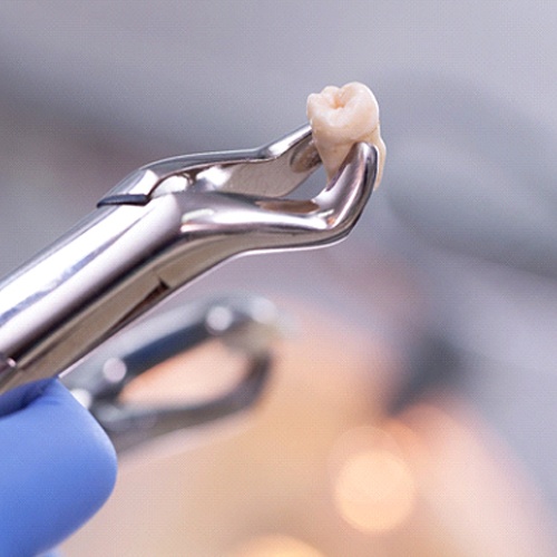 Dentist holding an extracted tooth with pair of forceps