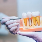 An up-close view of a dentist pointing to a dental implant inside a cross-section mouth mold