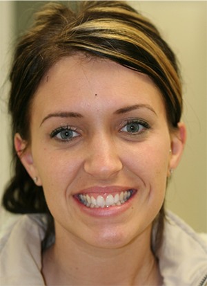 Young woman smiling after treatment from periodontist in Huntington Beach