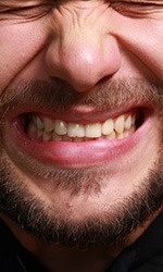 Gum disease patient showing his teeth while wincing
