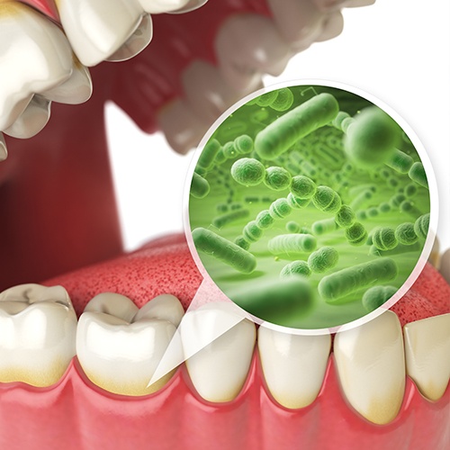Animation of smile and bacteria