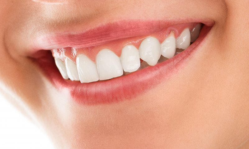 A gummy smile a periodontist in Huntington Beach can treat.