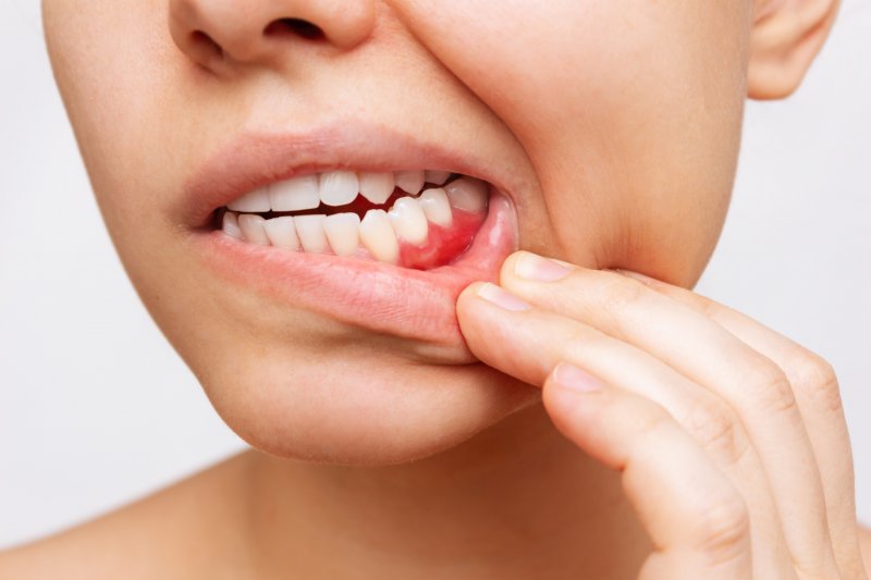 Patient looking at gum disease effects