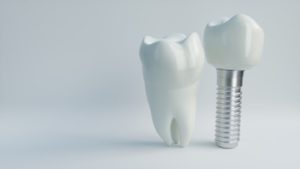 A picture of dental implants against a white background.