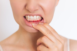 Closeup of someone’s inflamed gums